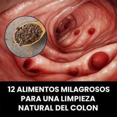 12 Remedios Naturales para Mantener el Colon Limpio y Saludable