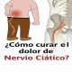 Soluciones efectivas para el dolor del nervio ciático