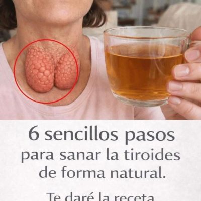 Remedios para curar las glándulas tiroides
