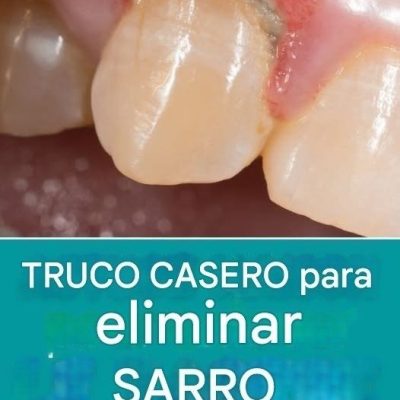 Consejo casero para eliminar el sarro tú mismo