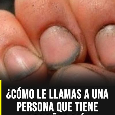 Lo que revelan las uñas descuidadas y por qué muchas personas las interpretan de forma equivocada