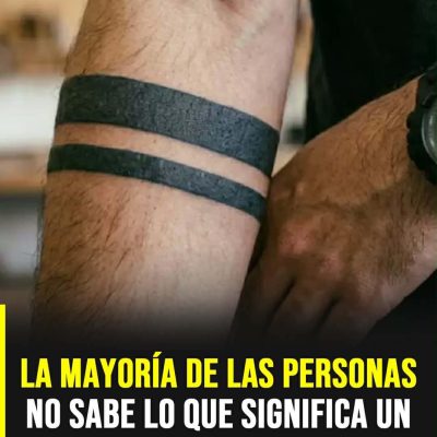 ¿Qué significa esta clase líneas en los brazos?